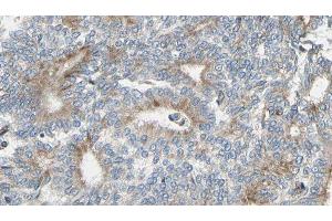 ABIN6275363 at 1/100 staining Human prostate tissue by IHC-P. (Plakophilin 4 antibody  (N-Term))