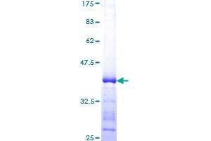 PRKDC Protein (AA 4019-4128) (GST tag)