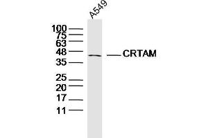 Human A549 cells probed with CRTAM Polyclonal Antibody, unconjugated  at 1:300 overnight at 4°C followed by a conjugated secondary antibody at 1:10000 for 90 minutes at 37°C.