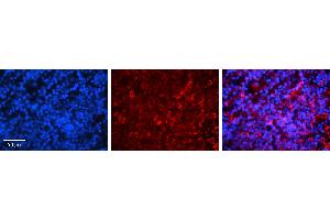Rabbit Anti-IRF3 Antibody   Formalin Fixed Paraffin Embedded Tissue: Human Lymph Node Tissue Observed Staining: Cytoplasm Primary Antibody Concentration: 1:100 Other Working Concentrations: 1:600 Secondary Antibody: Donkey anti-Rabbit-Cy3 Secondary Antibody Concentration: 1:200 Magnification: 20X Exposure Time: 0. (IRF3 antibody  (C-Term))