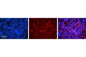 Rabbit Anti-IRF3 Antibody   Formalin Fixed Paraffin Embedded Tissue: Human Lymph Node Tissue Observed Staining: Cytoplasm Primary Antibody Concentration: 1:100 Other Working Concentrations: 1:600 Secondary Antibody: Donkey anti-Rabbit-Cy3 Secondary Antibody Concentration: 1:200 Magnification: 20X Exposure Time: 0.