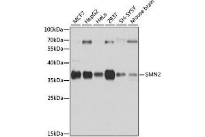 Western blot analysis of extracts of various cell lines, using SMN2 antibody. (SMN2 antibody)