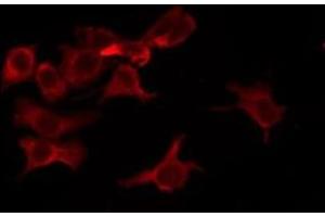 ABIN6276269 staining MCF7 by IF/ICC. (OR8B4 antibody)