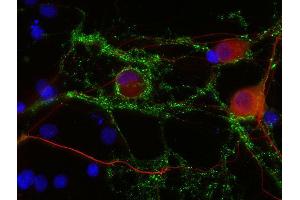 Indirect immunostaining of PFA fixed rat hippocampus neurons with anti-Neurofilament L (dilution 1 : 500; red) and mouse anti-Synapsin 1 (, dilution 1 : 1000; green).