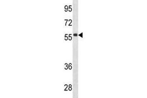 IGHD antibody western blot analysis in CEM lysate. (IgD antibody  (AA 37-64))
