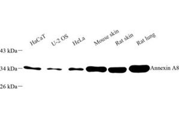 Annexin VIII antibody