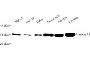 Western blot analysis of Annexin-A8 (ABIN7073071) at dilution of 1: 500