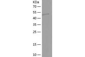 LHX4 Protein (AA 124-390) (His-IF2DI Tag)