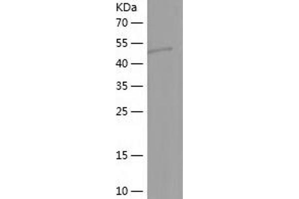 LHX4 Protein (AA 124-390) (His-IF2DI Tag)