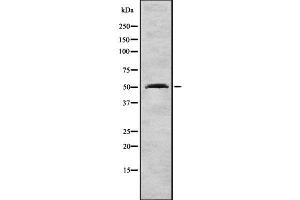 Western blot analysis FOXA1 using LOVO whole cell lysates (FOXA1 antibody  (C-Term))