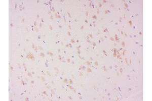 Formalin-fixed and paraffin embedded rat brain labeled with Anti-LATS2 (Ser83) Polyclonal Antibody, Unconjugated  at 1:300 followed by conjugation to the secondary antibody and DAB staining. (LATS2 antibody  (pSer83))