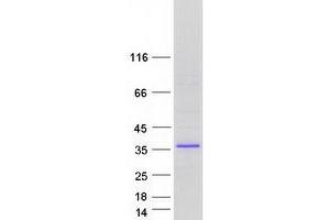 Four and A Half LIM Domains 1 (FHL1) (Transcript Variant 5) protein (Myc-DYKDDDDK Tag)