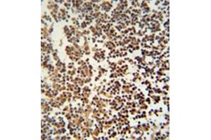 Immunohistochemistry analysis in formalin fixed and paraffin embedded human lymph tissue reacted with GTSF1 Antibody (Center) Cat.