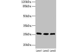 Western blot All lanes: LIN7A antibody at 6 μg/mL Lane 1: Human placenta tissue Lane 2: Mouse kidney tissue Lane 3: Mouse liver tissue Secondary Goat polyclonal to rabbit IgG at 1/10000 dilution Predicted band size: 26 kDa Observed band size: 26 kDa (LIN7A antibody  (AA 1-233))