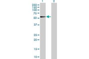Western Blot analysis of CALCR expression in transfected 293T cell line by CALCR MaxPab polyclonal antibody. (Calcitonin Receptor antibody  (AA 1-474))