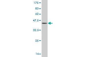 Western Blot detection against Immunogen (37. (CTNNAL1 antibody  (AA 277-380))