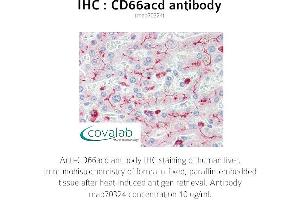 Image no. 1 for anti-Carcinoembryonic Antigen-Related Cell Adhesion Molecule 1/3/6 (CEACAM1/3/6) antibody (ABIN1723246) (CD66acd antibody)