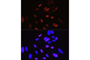 Immunofluorescence analysis of U-2 OS cells using Cyclin H Rabbit mAb (ABIN7266569) at dilution of 1:100 (40x lens). (Cyclin H antibody)