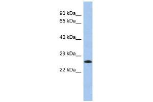 MGC50273 antibody used at 1 ug/ml to detect target protein. (MGC50273 (N-Term) antibody)
