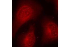 Immunofluorescence staining of methanol-fixed HeLa cells using Phospho-HDAC8-S39 antibody (ABIN2988043). (HDAC8 antibody  (pSer39))