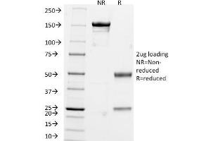 SDS-PAGE Analysis of Purified Chromogranin A Monoclonal Antibody (CHGA/765).