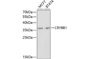 Western blot analysis of extracts of various cell lines, using CRYBB1 antibody  at 1:1000 dilution. (CRYBB1 antibody  (AA 1-252))