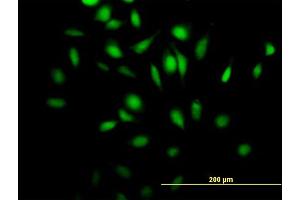 Immunofluorescence of purified MaxPab antibody to Rgr on HeLa cell. (RGL4 antibody  (AA 1-410))