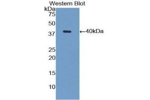 Detection of recombinant VCAM1 using Polyclonal Antibody to Vascular Cell Adhesion Molecule 1 (VCAM1) (VCAM1 antibody  (AA 409-682) (APC))