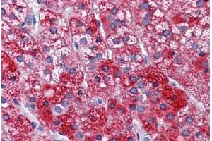 Human Adrenal: Formalin-Fixed, Paraffin-Embedded (FFPE) (SH3BP5 antibody  (AA 4-113))