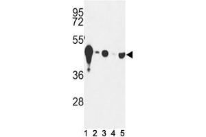 Western blot analysis of NSE antibody and (1) mouse cerebellum tissue and (2) Y79, (3) HepG2, (4) Jurkat and (5) CEM lysate. (ENO2/NSE antibody  (AA 6-32))