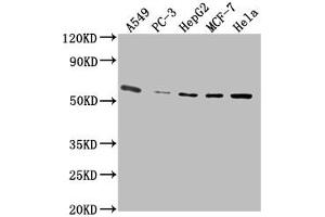 Western Blot Positive WB detected in: A549 whole cell lysate, PC-3 whole cell lysate, HepG2 whole cell lysate, MCF-7 whole cell lysate, Hela whole cell lysate All lanes: PD-L1 antibody at 1:2500 Secondary Goat polyclonal to Mouse IgG at 1/10000 dilution Predicted band size: 33 kDa Observed band size: 55 kDa (PD-L1 antibody  (AA 19-238))