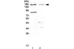 Western blot testing of 1) rat pancreas and 2) mouse NIH 3T3 lysate with NPC1 antibody at 0. (NPC1 antibody  (AA 1022-1278))