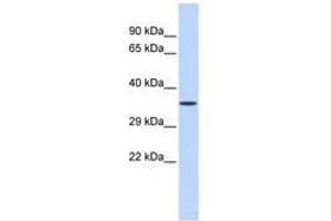 Image no. 1 for anti-Zinc Finger Protein 124 (ZNF124) (C-Term) antibody (ABIN6740539) (ZNF124 antibody  (C-Term))