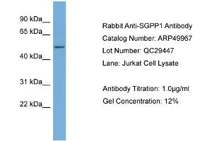 WB Suggested Anti-SGPP1  Antibody Titration: 0. (SGPP1 antibody  (Middle Region))