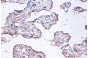 Immunohistochemistry of paraffin-embedded human placenta tissue using ABIN7148312 at dilution of 1:100 (COMMD4 antibody  (AA 1-195))