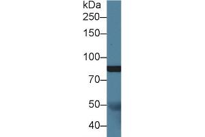 Detection of Slit1 in Porcine Cerebrum lysate using Polyclonal Antibody to Slit Homolog 1 (Slit1) (SLIT1 antibody  (AA 647-835))