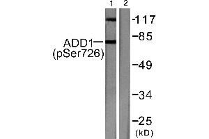Western blot analysis of extracts from Hela cells treated with Forskolin (40nM, 30mins), using ADD1 (phospho-Ser726) antibody (#A0002). (alpha Adducin antibody  (pSer726))