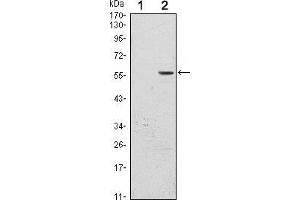 Western blot analysis using CD276 mAb against HEK293 (1) and CD276(AA: 30-130)-hIgGFc transfected HEK293 (2) cell lysate. (CD276 antibody)