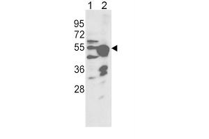 Western Blotting (WB) image for anti-Cytochrome P450, Family 2, Subfamily R, Polypeptide 1 (CYP2R1) antibody (ABIN3003559)