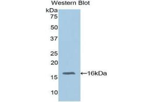 Western blot analysis of the recombinant protein. (RBP3 antibody  (AA 1027-1229))