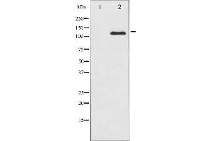 Western blot analysis of c-Kit expression in HeLa whole cell lysates,The lane on the left is treated with the antigen-specific peptide. (KIT antibody  (Internal Region))