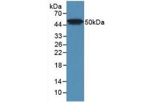 Detection of Recombinant LpPLA2, Human using Monoclonal Antibody to Phospholipase A2 Group VII (LpPLA2) (PLA2G7 antibody  (AA 22-441))