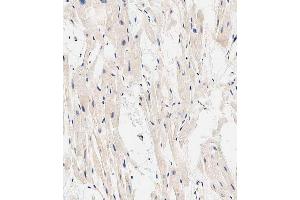 Immunohistochemical analysis of paraffin-embedded human heart tissue using A performed on the Leica® BOND RXm. (EHD2 antibody  (C-Term))