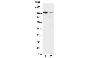 Western blot testing of Integrin alpha 3 antibody and Lane 1:  rat heart (ITGA3 antibody  (N-Term))