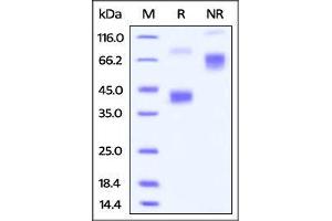 FITC-Labeled Human BCMA, Fc Tag on SDS-PAGE under reducing (R) and no-reducing (NR) conditions. (BCMA Protein (AA 1-54) (Fc Tag,FITC))
