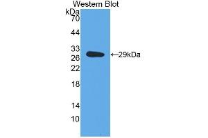 Detection of Recombinant DbH, Human using Polyclonal Antibody to Dopamine Beta Hydroxylase (DbH) (DBH antibody  (AA 335-571))