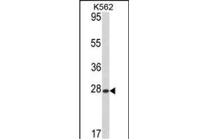 Western blot analysis of hARL1-G3 (ABIN388997 and ABIN2839227) in K562 cell line lysates (35 μg/lane).