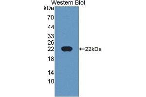 Detection of Recombinant CDKN2D, Human using Polyclonal Antibody to Cyclin Dependent Kinase Inhibitor 2D (CDKN2D)