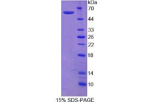 Image no. 1 for Sema Domain, Immunoglobulin Domain (Ig), Short Basic Domain, Secreted, (Semaphorin) 3E (SEMA3E) (AA 32-516) protein (His tag) (ABIN6236469) (SEMA3E Protein (AA 32-516) (His tag))