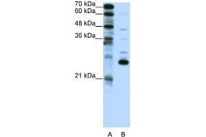 WB Suggested Anti-RCV1 Antibody Titration:  0. (Recoverin antibody  (C-Term))